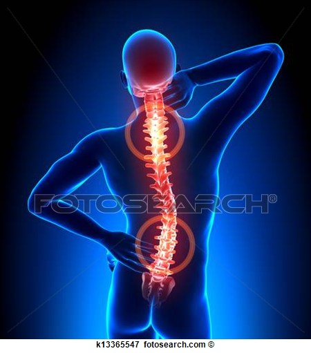 Picture   Spine Pain   Vertebrae Trauma  Fotosearch   Search Stock