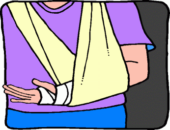 Broken Arm Clip Art   Cliparts Co