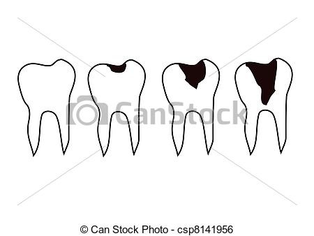 Stock Illustration Of Tooth Decay   Tooth Csp8141956   Search Clip Art