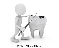 Tooth Decay Illustrations And Clipart