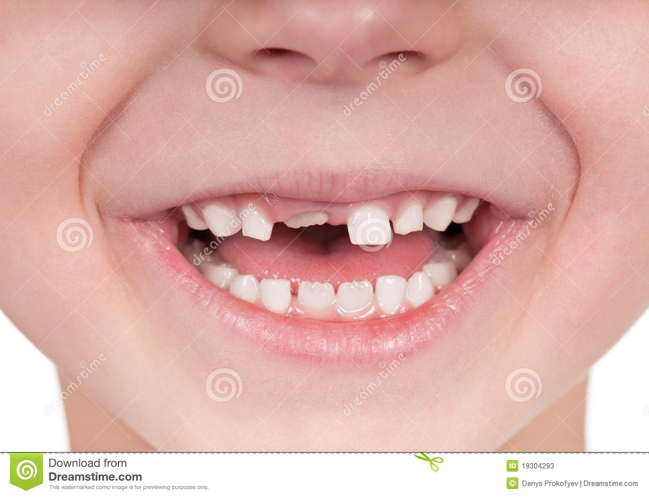 Happy Little Girl Or Boy Toothless Smile Close Up 