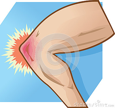 Go Back   Gallery For   Hurt Knee Clipart
