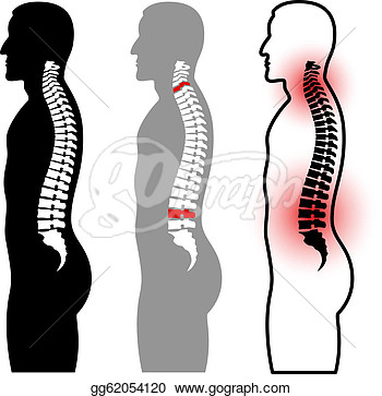 Illustration   Vector Human Spine Silhouettes  Clipart Gg62054120