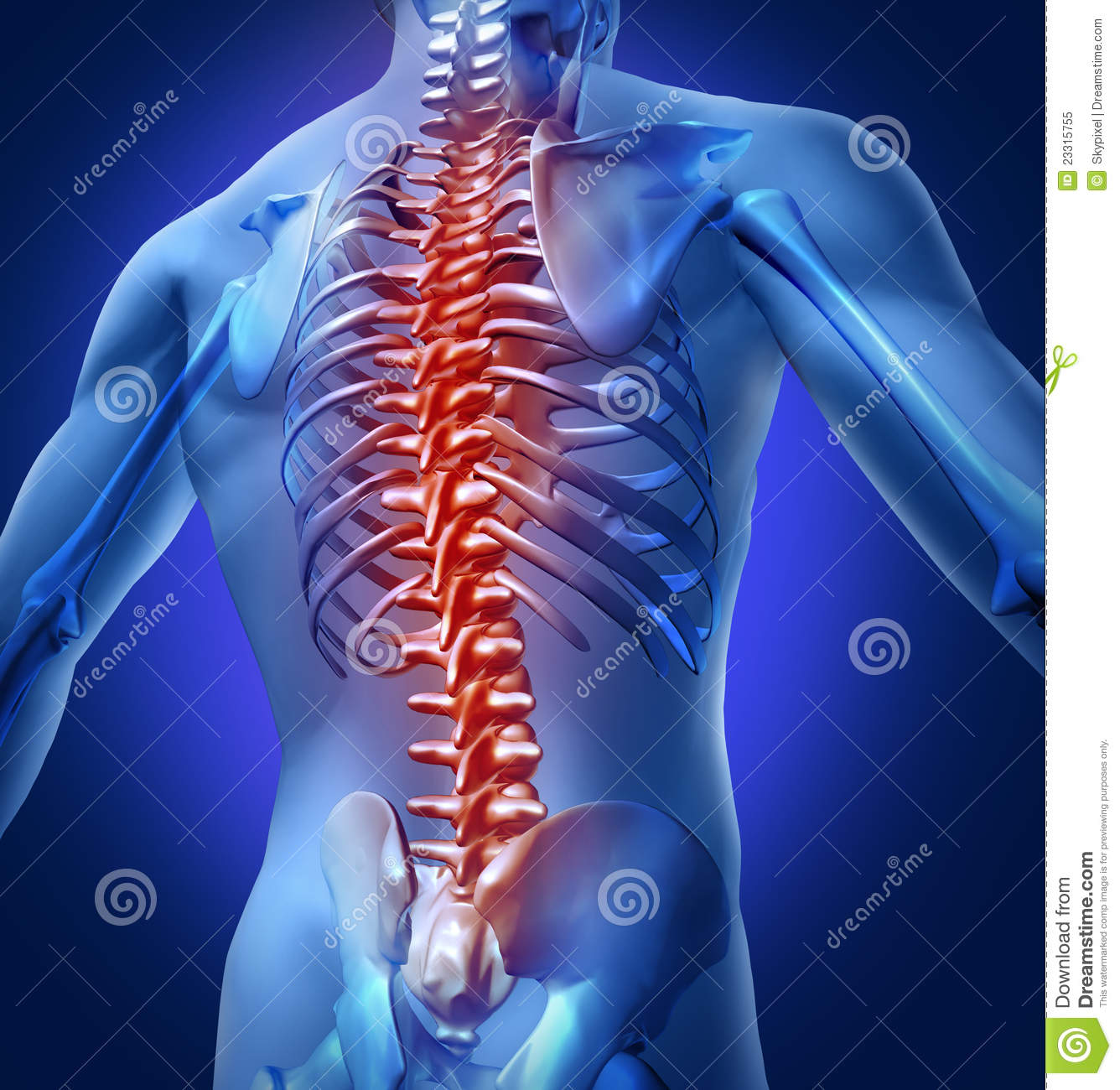 Human Backache And Back Pain With An Upper Torso Body Skeleton Showing