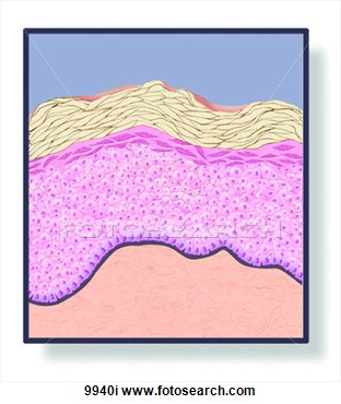 Clip Art Of Skin Wheal Unlabeled