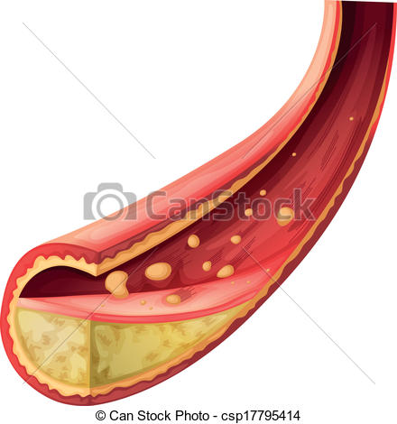 Artery    Csp17795414   Search Clipart Illustration Drawings And