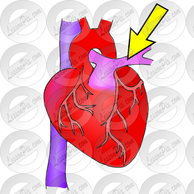 Picture For Classroom   Therapy Use   Great Pulmonary Artery Clipart