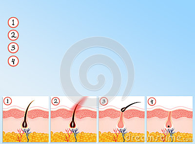 Hair Removal Stock Illustration   Image  51842947