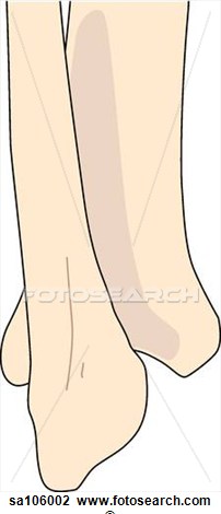 Right Ankle Joint Showing Fibula And Tibia  Sa106002   Search Clipart    