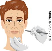 Male Surgery Scalpel   Illustration Of A Man With A Scalpel