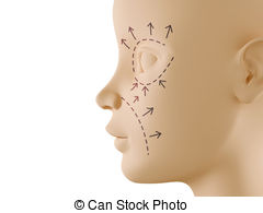 Neutral Face Profile With Aesthetic Surgery Sign Drawing