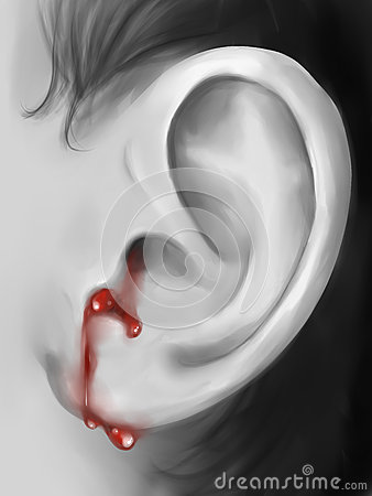 Digital Art Of A Bleeding Ear Close Up  The Ear Temple And Hair Are    