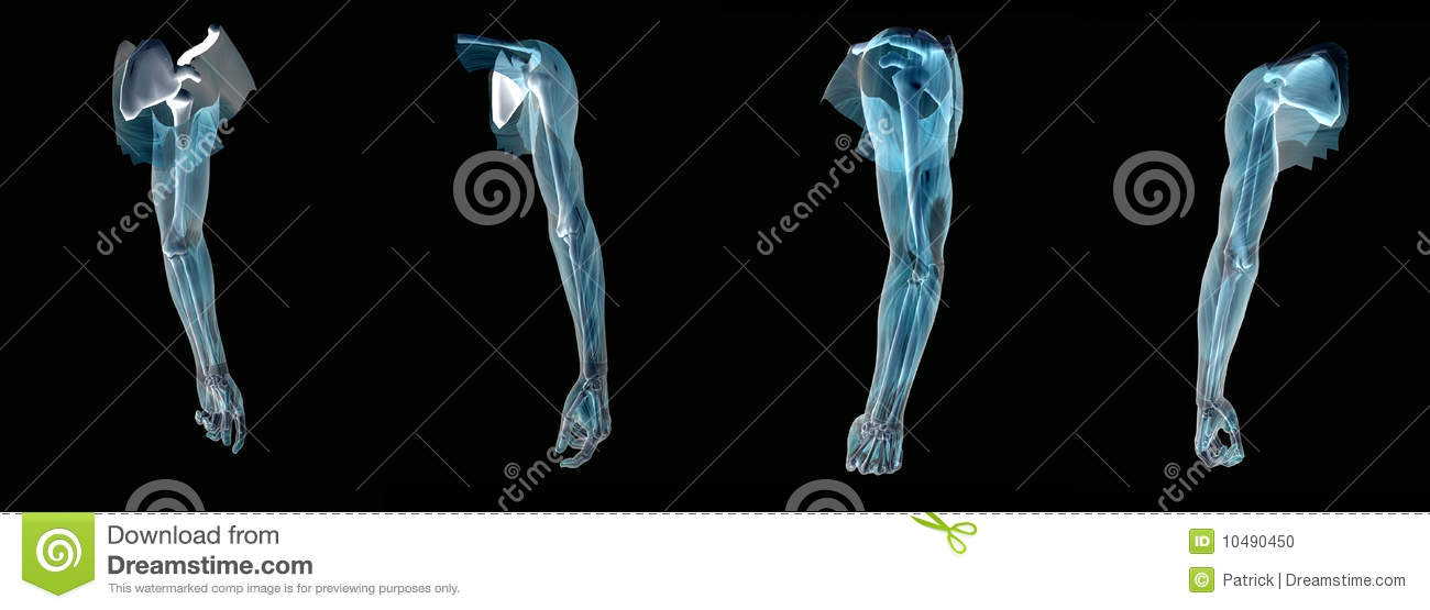 Anatomically Correct Medical Model Of The Human Arm X Ray 