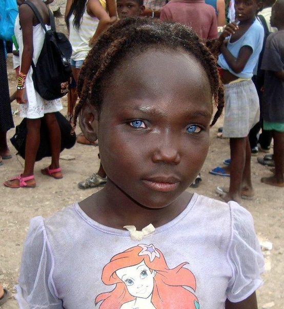 Black People With Blue Eyes  Natural Phenomenon Or Genetic Mutation