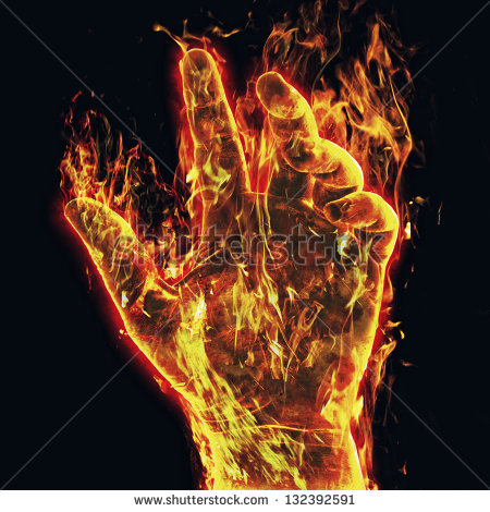 Burn Hand Stock Photos Images   Pictures   Shutterstock