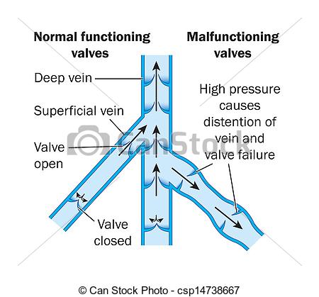 Vein Valves       Csp14738667   Search Clipart Illustration Drawings