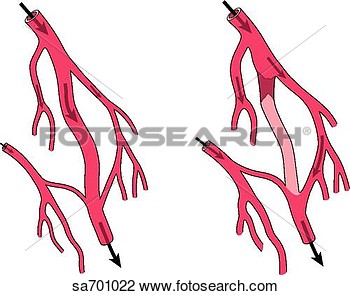 Clip Art Of System Of Blood Vessels Capable Of Providing More Than One