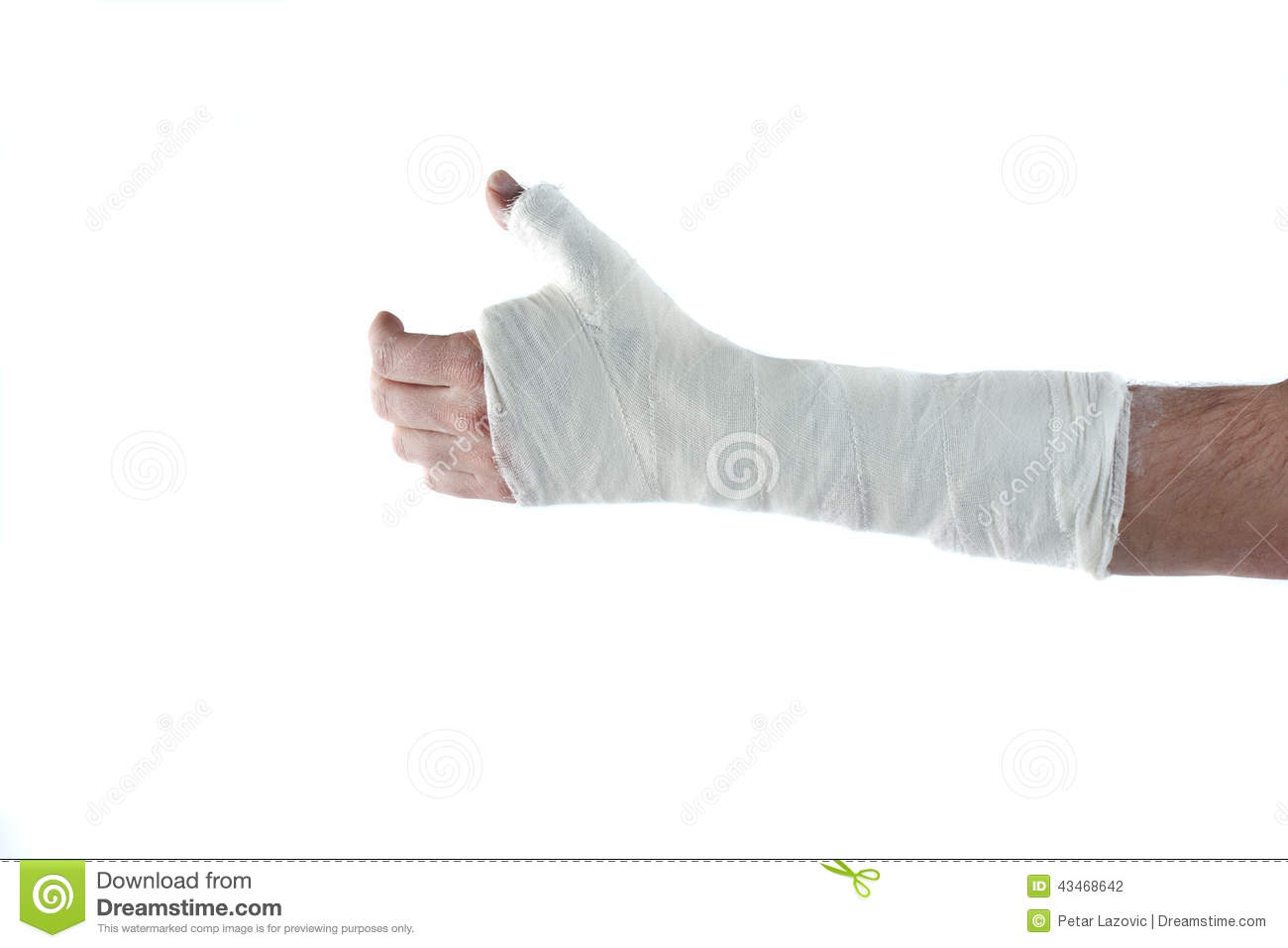 Arm In Plaster Cast Stock Photo   Image  43468642