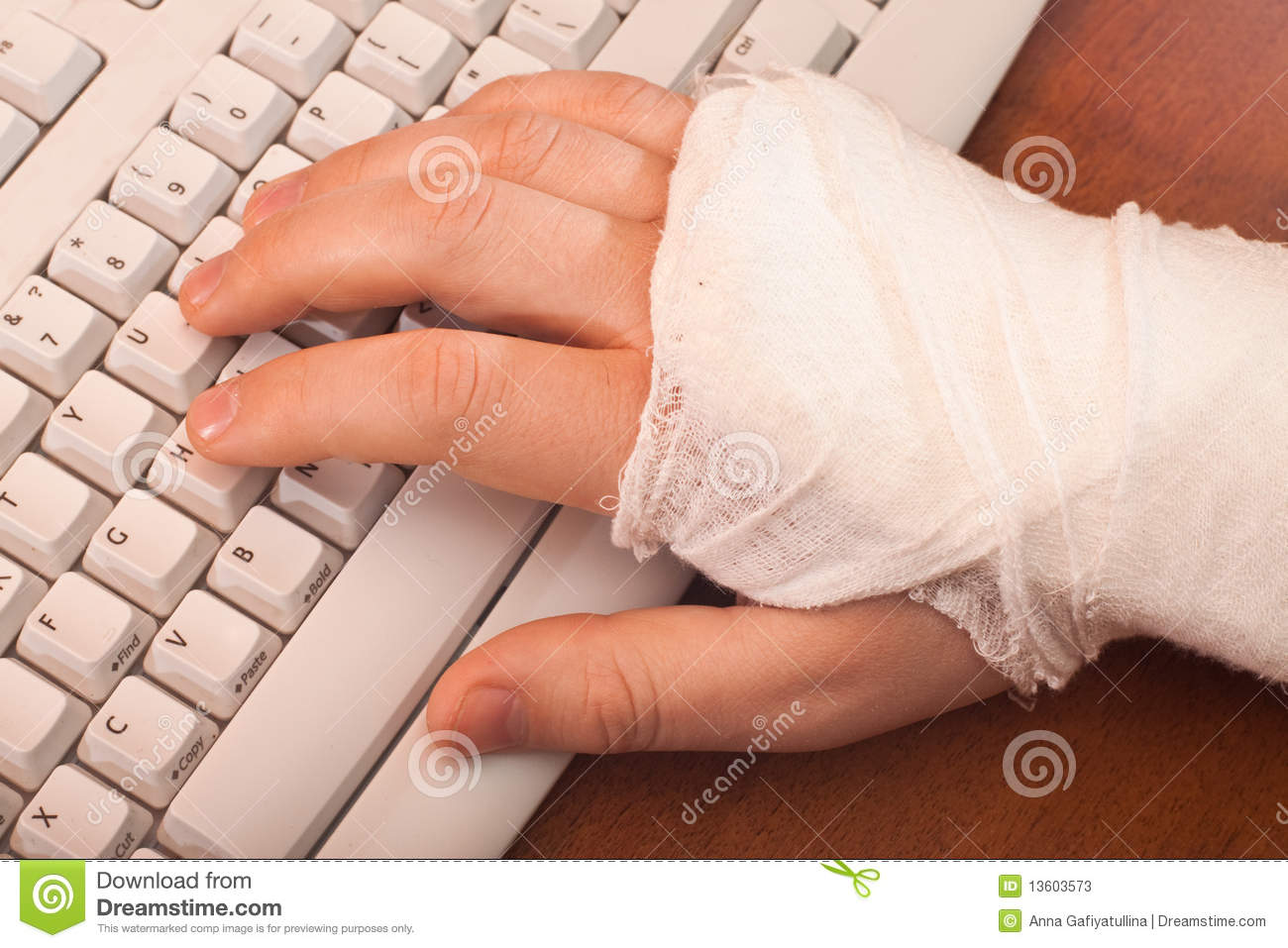 Arm In Plaster On The Keyboard Stock Photos   Image  13603573