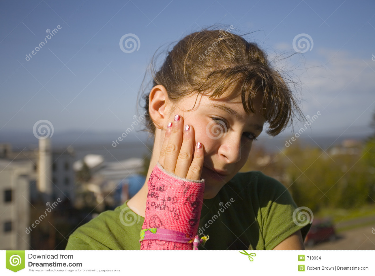     Of Young Girl With Broken Arm In Colorful Plaster Cast Outdoors