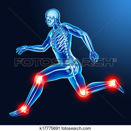 Clipart   Leg Joint Pain  Fotosearch   Search Clip Art Illustration