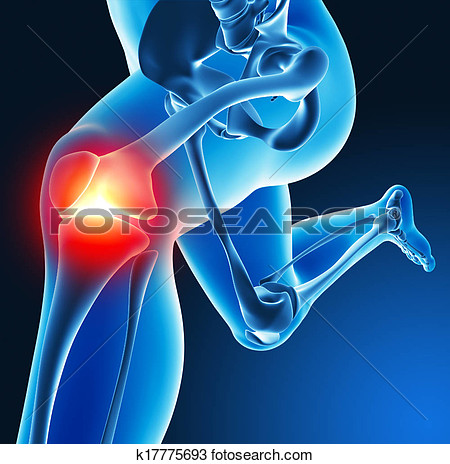 Drawing   Leg Joint Pain  Fotosearch   Search Clipart Illustration