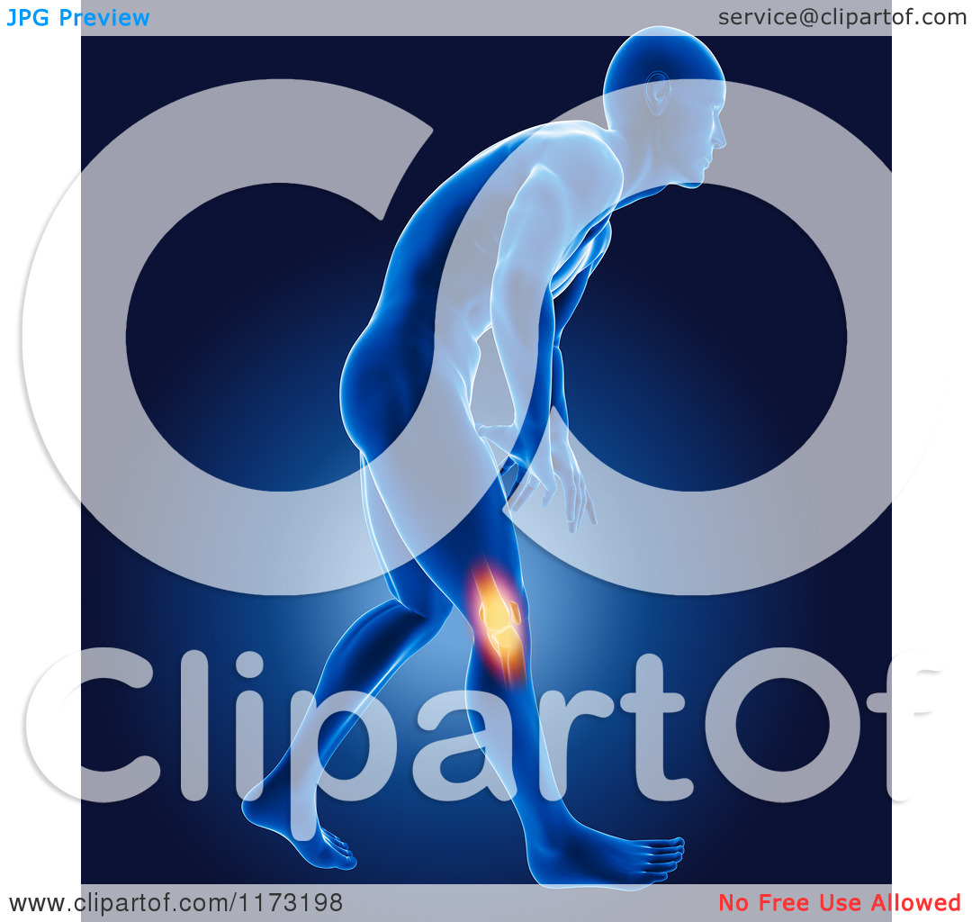 Joint Pain Clipart