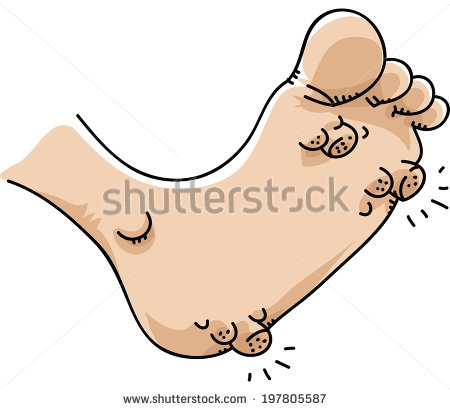 Warts Stock Photos Images   Pictures   Shutterstock