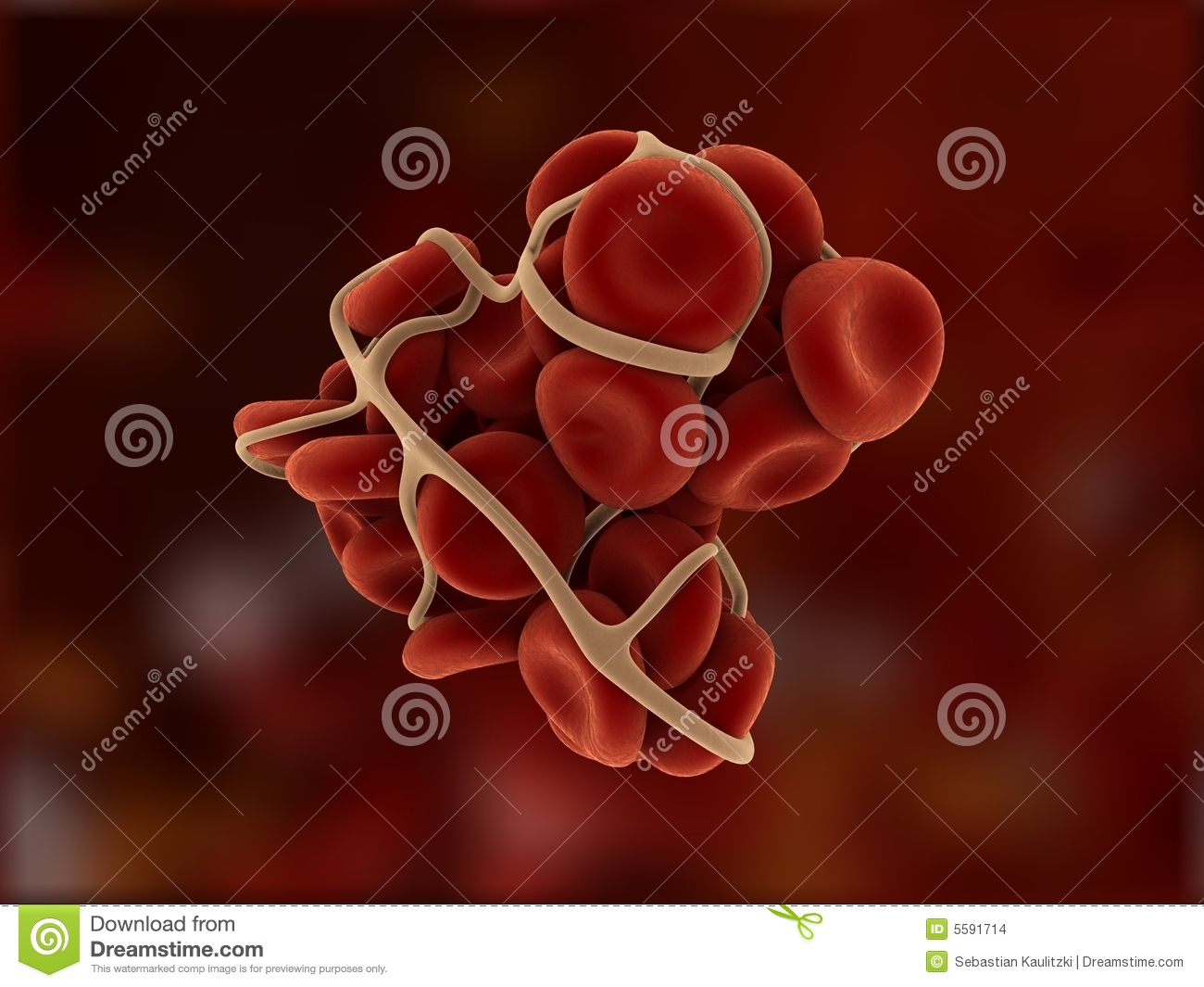 Blood Clot Stock Images   Image  5591714