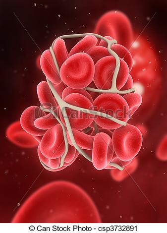 Clipart Of Blood Clot   3d Rendered Illustration Of A Blood Clot In An