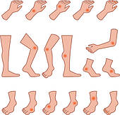 Clipart Of Ankle Sprains