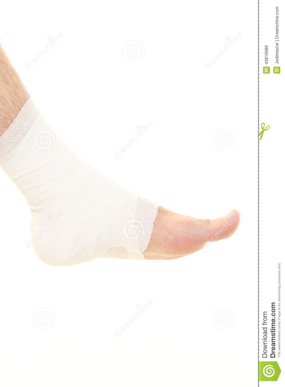 Close Up Shot Of Sprained Ankle 