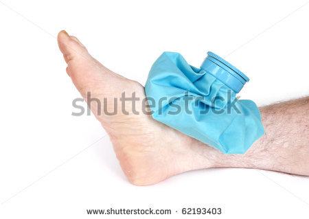 Go Back   Gallery For   Sprained Ankle Clipart