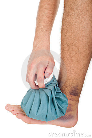 Sprained Ankle Clipart Icing Sprained Ankle 19772805 Jpg