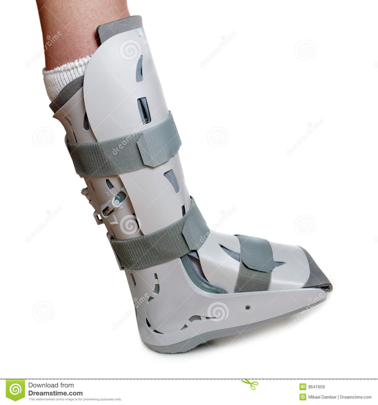Twisted Ankle Clipart Severe Ankle Sprain