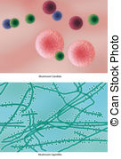 Skin Infection Illustrations And Clipart