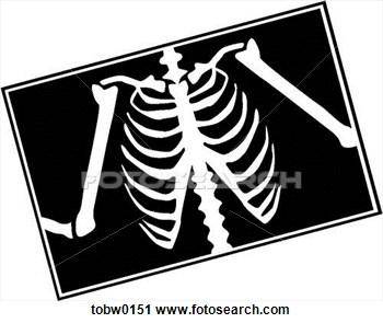 Related Pictures X Ray Clip Art