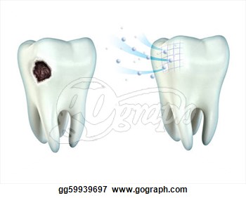 Drawing   Teeth Cavity  Clipart Drawing Gg59939697