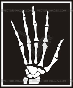 Hand X Ray Snapshot   Vector Clipart