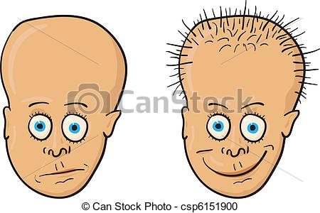 Clipart Of Vector Illustration   Patient With A Bald Head And Hair