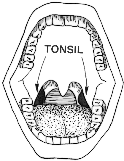 Www Wpclipart Com Medical Anatomy Mouth And Throat Tonsil Png Html