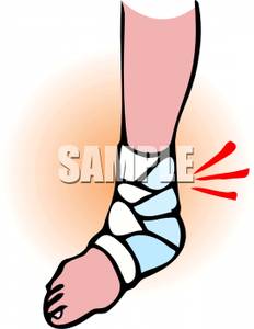 Cast On A Broken Ankle   Royalty Free Clipart Picture