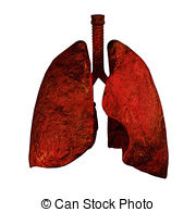 Lungs Od Smokers   Human Lungs And Bronchi In X Ray View