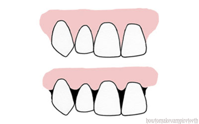 Pin Cow Teeth Diagram Pictures On Pinterest