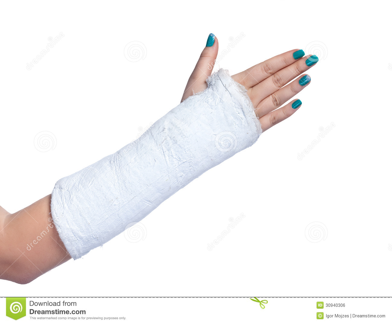 Full Body Cast Clip Art Arm In A Plaster Cast On A