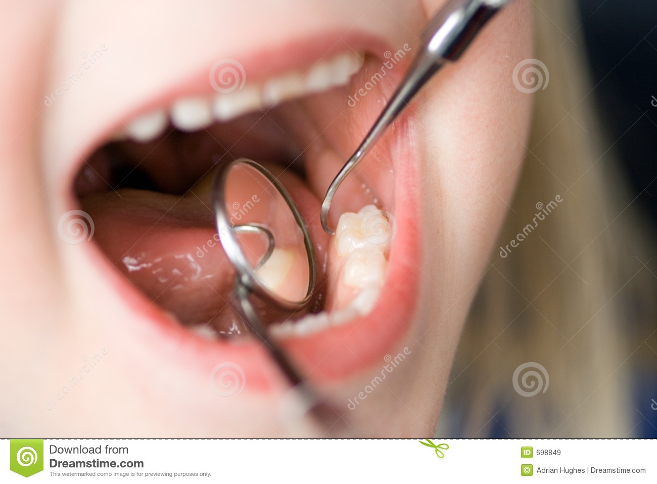 Child Dental Check Up Royalty Free Stock Images   Image  698849