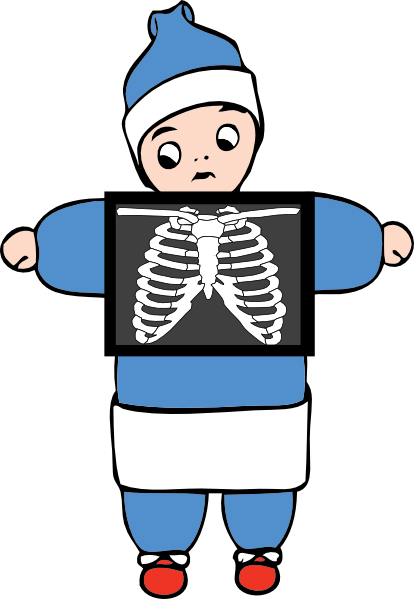 Go Back   Gallery For   X Ray Clipart For Kids
